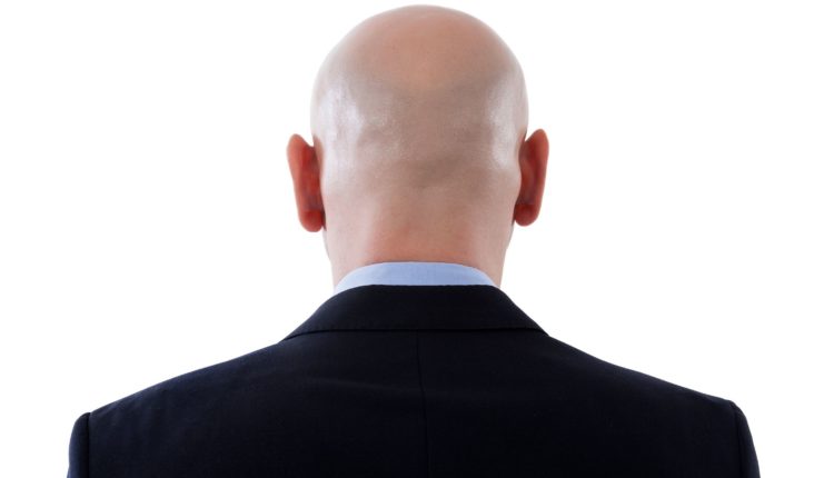 The Ultimate Guide to Treating Dandruff for Bald People - Nebanye